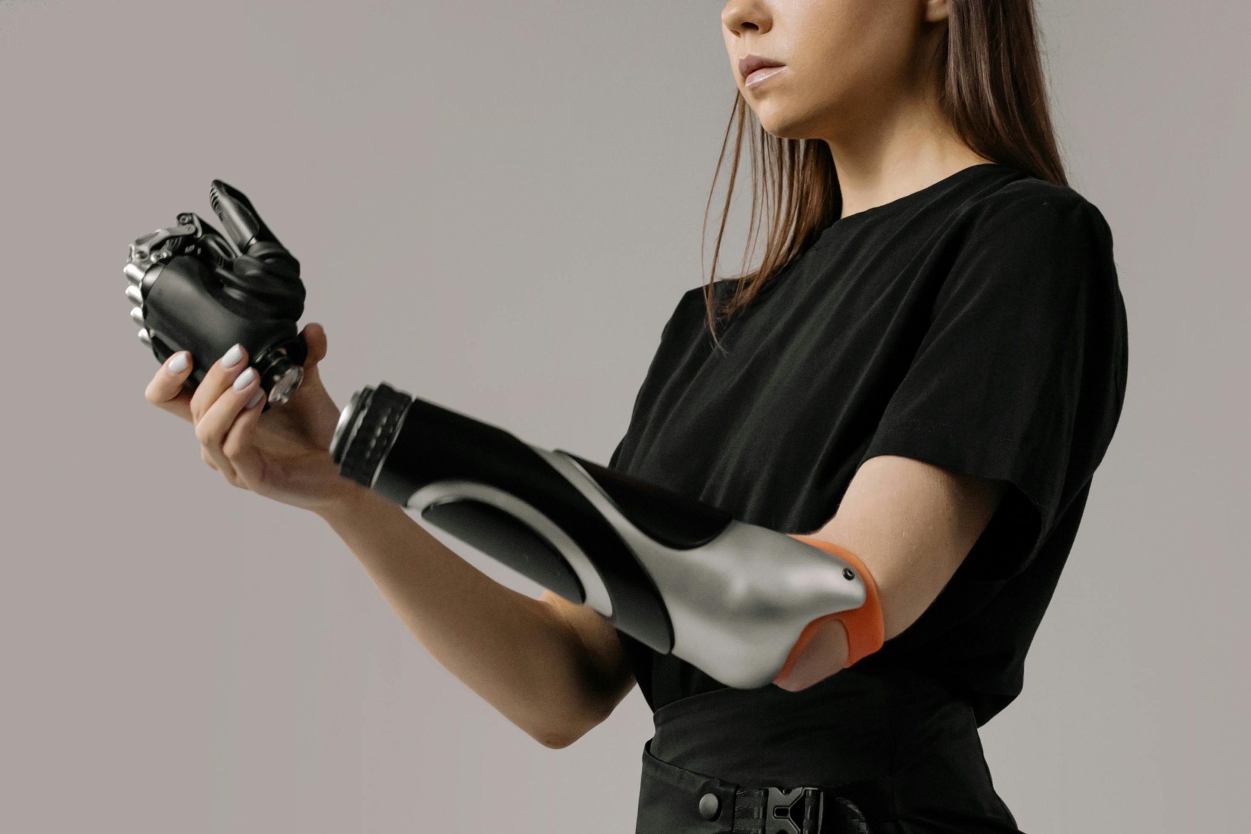 Young woman with a modern prosthetic arm showcasing advanced technology.